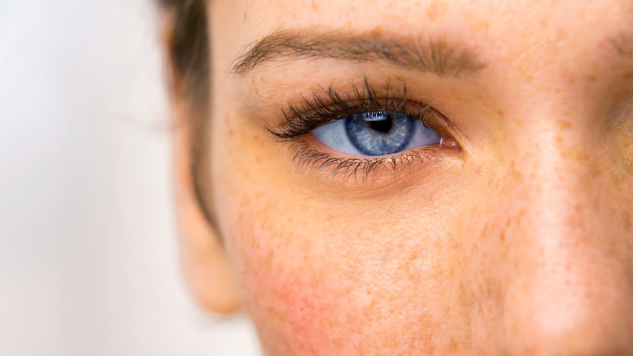 Common Acne Medications Double the Risk of Eye Infections | Distasio