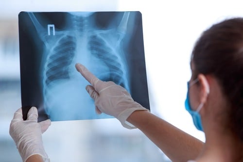Nursing Home Fails to Complete X-Ray for Resident, Results in Delay of Treatment