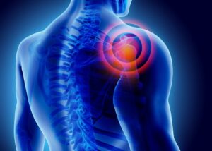 Shoulder Pain After a Car Accident